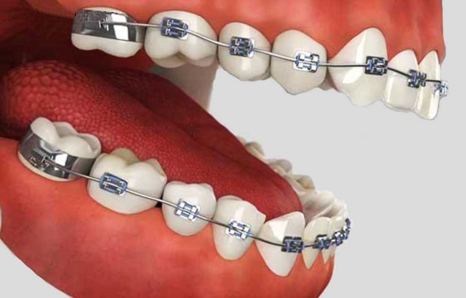 Orthodontics burwood