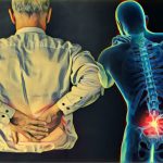 back pain in Earlwood