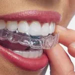 invisalign westmead
