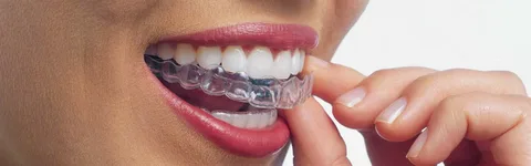 invisalign westmead