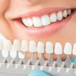 Veneers Sutherland