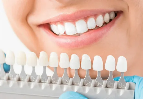 Veneers Sutherland