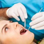 wisdom teeth removal bankstown