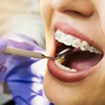 Orthodontics Parramatta