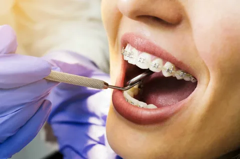 Orthodontics Parramatta